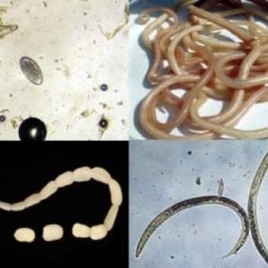 Terapéutica antiparasitaria