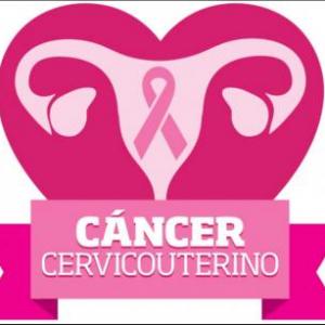 CANCER DE CUELLO UTERINO