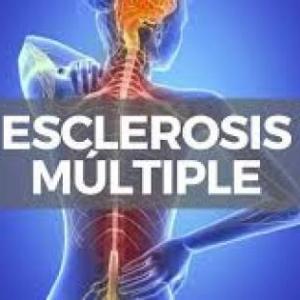 ESCLEROSIS MULTIPLES