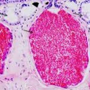 Preguntas y repuestas sobre el tejido epitelial glandular