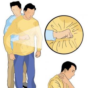 MANIOBRA DE HEIMLICH