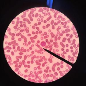 TEJIDO SANGUINEO Y HEMATOPOYESIS