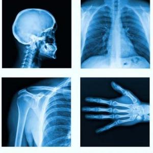 craneo posiciones especiales rx