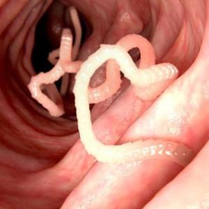 Antiparasitarios 
