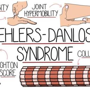 EHLER DANLOS
