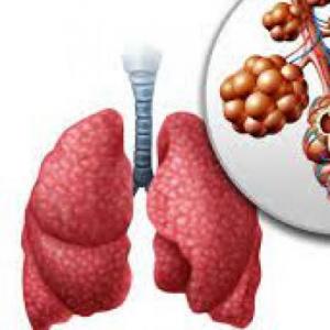 OXIGENOTERAPIA