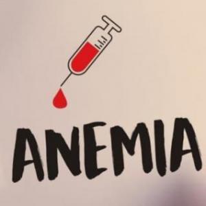 Anemia: Hábitos de mi vida Universitaria