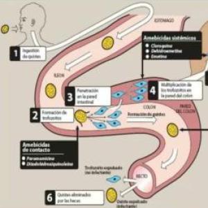 Amebiasis