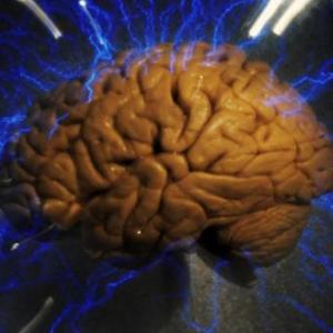 Aprendiendo sobre la Epilepsia