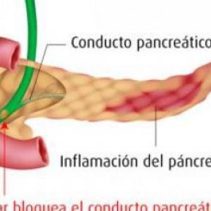Imagen de portada del videojuego educativo: Pancreatitis, de la temática Salud