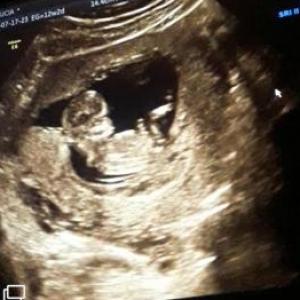 Lucia Gender Reveal