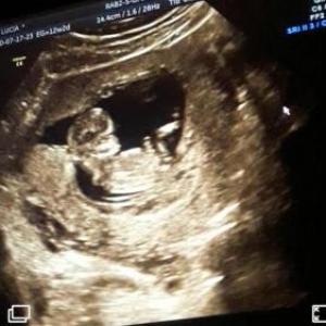 Lucia Gender Reveal