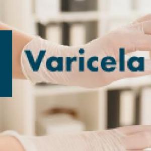 TRIVIA VARICELA