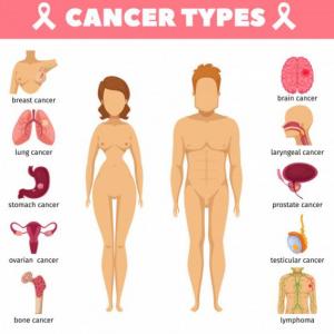 Juego sobre los tipos de Cáncer