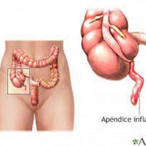 prueba de abdomen