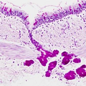 Tejido glandular