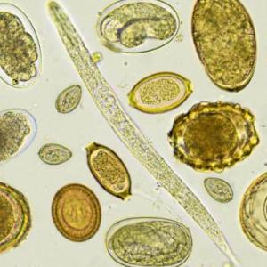 Antiparasitarios