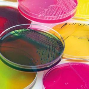 Medios de cultivos y pruebas bioquímicas