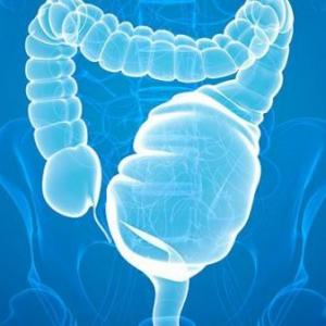 APRENDIENDO SOBRE EL MEGACOLON
