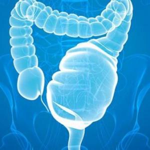 Aprendiendo sobre el Megacolon