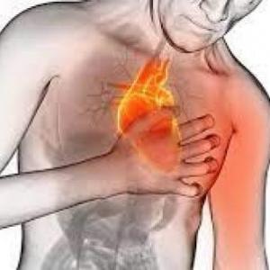 ATAQUE AL CORAZÓN