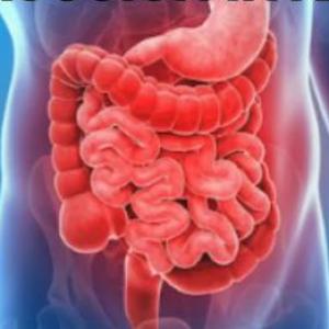 Obstrucción intestinal