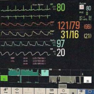 METODOS DE MONITOREO HEMODINÁMICO