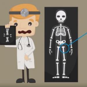 Osteojuego