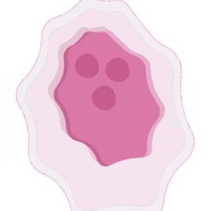 El cáncer