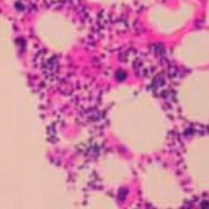 Tejido sanguíneo y hematopoyesis.