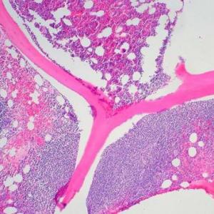 Hematopoyesis