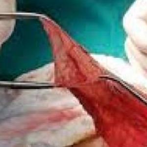 Imagen de portada del videojuego educativo: Pinzas para Hemostasia, de la temática Salud