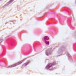 TEJIDO SANGUINEO Y HEMATOPOYESIS