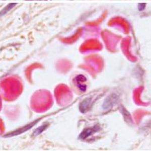 TEJIDO SANGUINEO Y HEMATOPOYESIS