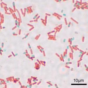 ¿Qué tanto sabe de las esporas bacterianas?