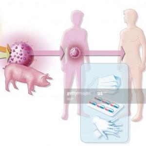 H1N1