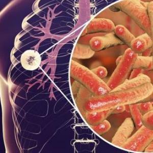 Mycobacterium Tuberculosis