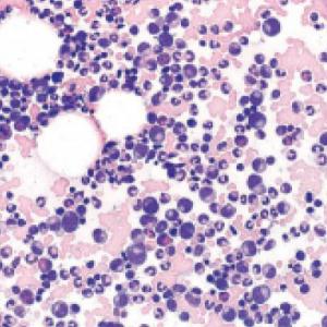 tejido sanguíneo y hematopoyesis