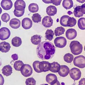 tejido sanguíneo y hematopoyesis