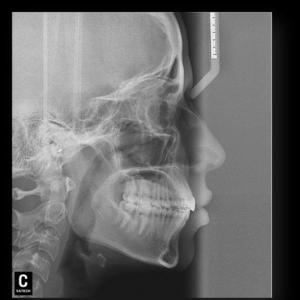 RADIOGRAFIAS  EXTRAORALES